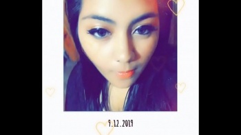 Анальные трещины мазь